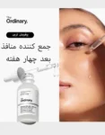 نعع