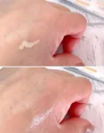 منختعاعخ
